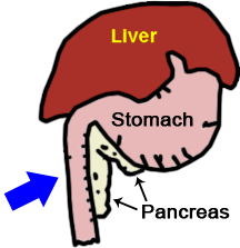 The pancreas is nestled along the stomach and small intestine.