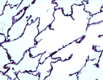 Section of normal cat lung. White areas would be full of air.