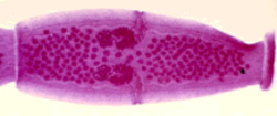 Microscopic view of a tapeworm segment