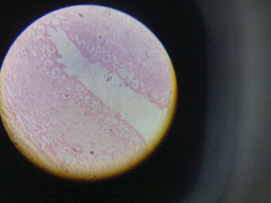 Transitional epithelium as seen under microscope