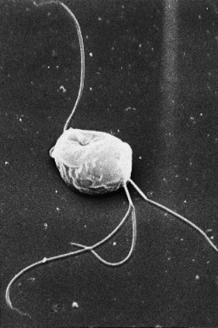 Electron Micrograph of a Tritrichomonas organism