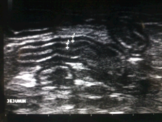 Ultrasound image of a cat with intestinal lymphoma