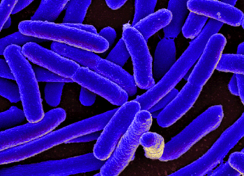 Scanning electron micrograph of E. coli bacteria