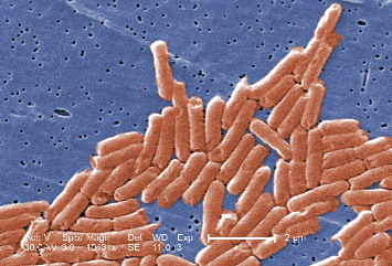 High magnification image of Salmonella bacteria under the microscope