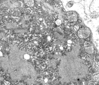 Bullet-shaped rabies virus particles in brain tissue