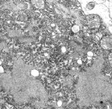 Electron micrograph of the Rabies Virus small PHIL