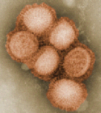 swine flu virus small cdc