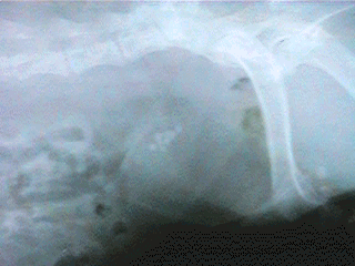 Radiograph showing a urinary bladder full of stones