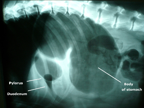 stomach bloat radiograph wiki
