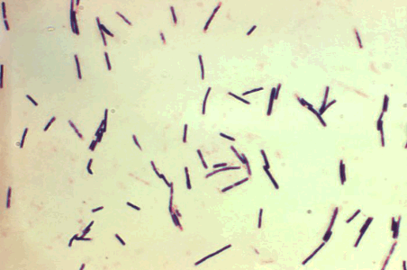 Clostridium perfringens spores under the microscope