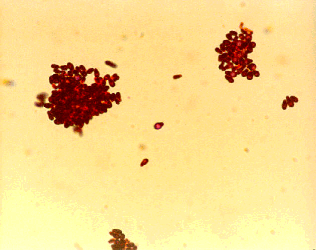 The dark footprint-like structures seen here are the yeast organisms: 
