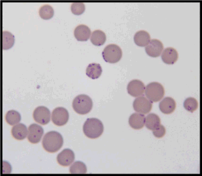 red blood cells parasitized by Mycoplasma haemofelis