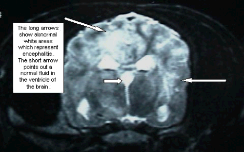 MRI is an important part of the brain diagnostic process.