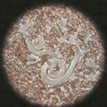 microfilaria in a blood smear