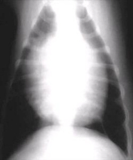 The radiograph shows what appears to be very large heart.