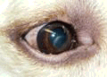 Ocular (Eye) Signs