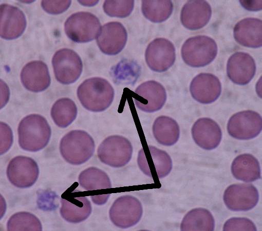 Image Showing Immune Destruction of Blood Platelets