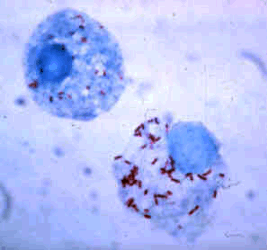 Neorickettsia rickettsia organisms (staining red) inside host blood cells.
