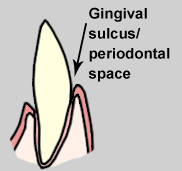 illustration of gingival sulcus 