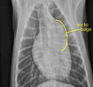 Chest radiograph of a puppy with SAS.