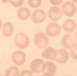 Microscopic View of a group of Red Blood Cells.
